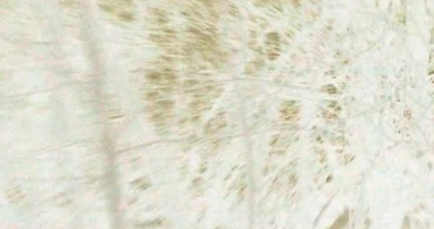 Melodic Echoes: The Art of Vocal Repetition